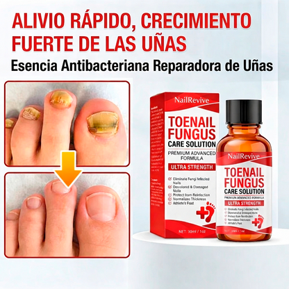 NailRevive™ Sérum Reparador de Uñas [Fuerza y Salud Inmediata]