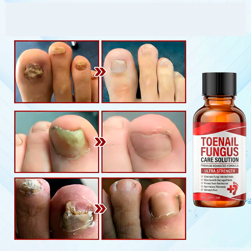 NailRevive™ Sérum Reparador de Uñas [Fuerza y Salud Inmediata]
